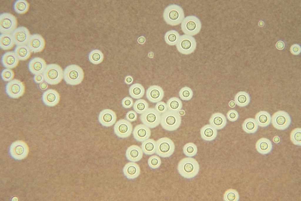Cryptococcus_neoformans